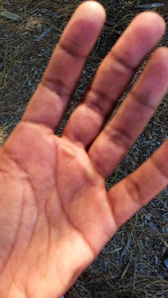 The rings do mess up your hands.